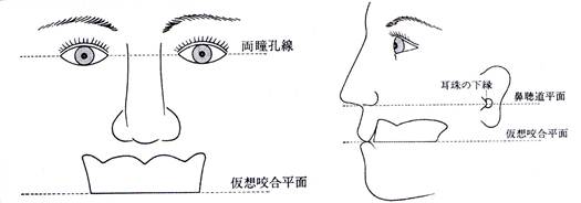 Willis法