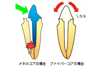 破折の可能性