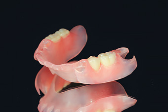 金属のばねのない入れ歯(部分入れ歯)