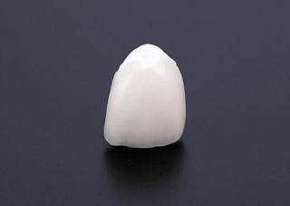 ポーセレンジルコニアクラウン